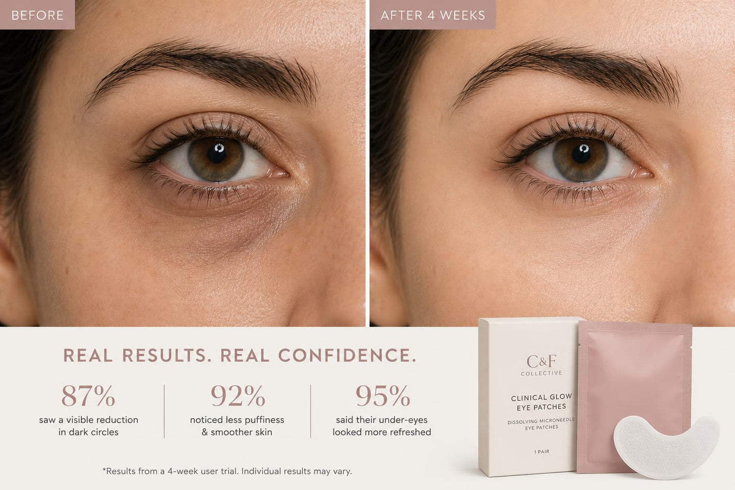 Clinical Glow Dissolving Microneedle Eye Patches | C&F Collective™